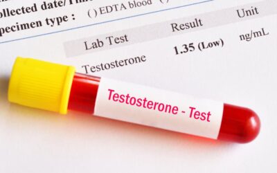What Causes Low Testosterone