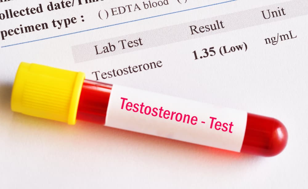 Vial of Blood labeled - "Testosterone Test"