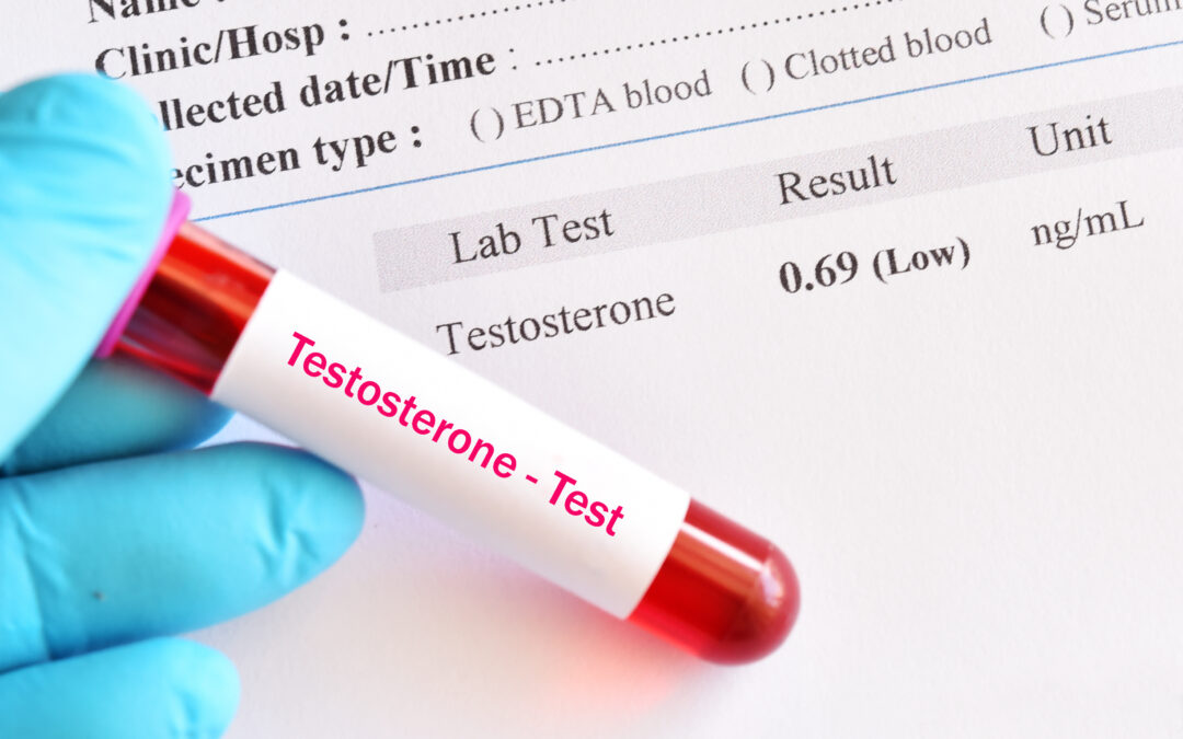 Signs of Low Testosterone and Symptoms to Look Out For