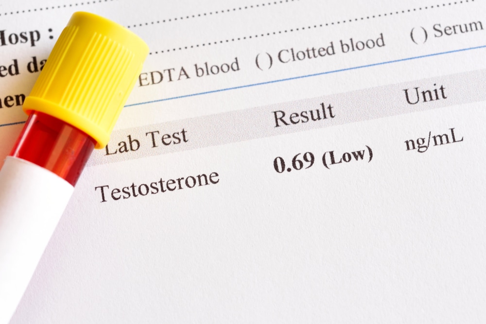 Testosterone Deficiency. Jarun Ontakrai.ehormones.com